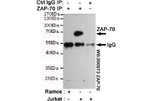 Immunoprecipitation analysis of Jurkat cell lysates (Z70 positive expression cell line)and Ramos cell lysates(Z70 negative expression cell line) using Z70 mouse mAb. (ZAP70 Antikörper)