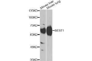 Western blot analysis of extracts of various cell lines, using BEST1 antibody (ABIN6290112) at 1:1000 dilution. (Bestrophin 1 Antikörper)