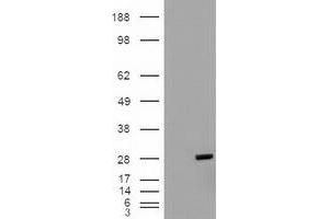 HEK293T cells were transfected with the pCMV6-ENTRY control (Left lane) or pCMV6-ENTRY BCL2L1 (RC201314) (Right lane) cDNA for 48 hrs and lysed. (BCL2L1 Antikörper  (AA 1-212))