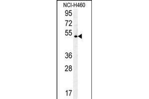 DENND1B Antibody (N-term) (ABIN654339 and ABIN2844110) western blot analysis in NCI- cell line lysates (35 μg/lane). (DENND1B Antikörper  (N-Term))