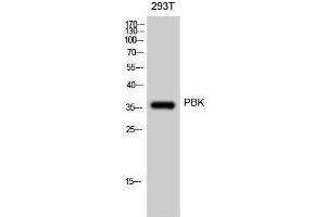 Western Blotting (WB) image for anti-PDZ Binding Kinase (PBK) (Tyr685), (Tyr753) antibody (ABIN3176791) (PBK Antikörper  (Tyr685, Tyr753))