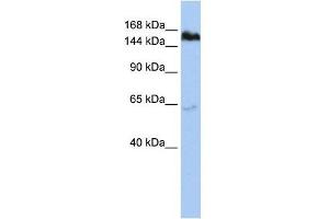 TNKS antibody used at 1 ug/ml to detect target protein. (TNKS Antikörper  (Middle Region))