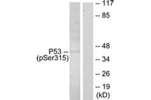 Western blot analysis of extracts from ovary cancer, using p53 (Phospho-Ser315) Antibody. (p53 Antikörper  (pSer315))