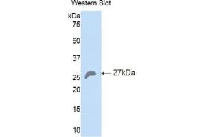 Detection of Recombinant HSPA5, Mouse using Polyclonal Antibody to Heat Shock 70 kDa Protein 5 (HSPA5) (GRP78 Antikörper  (AA 261-470))