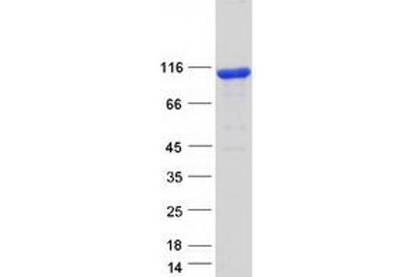 FAM160B1 Protein (Transcript Variant 1) (Myc-DYKDDDDK Tag)