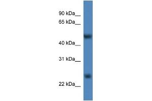 WB Suggested Anti-Mettl4 Antibody Titration:  0. (METTL4 Antikörper  (C-Term))