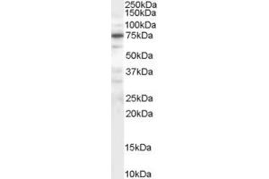 Western Blotting (WB) image for anti-Protein Phosphatase 1, Regulatory (Inhibitor) Subunit 15A (PPP1R15A) (AA 664-674) antibody (ABIN291973) (GADD34 Antikörper  (AA 664-674))