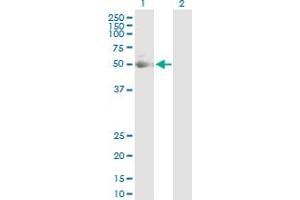 Western Blot analysis of KRT7 expression in transfected 293T cell line by KRT7 MaxPab polyclonal antibody. (Cytokeratin 7 Antikörper  (AA 1-469))