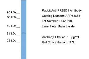 WB Suggested Anti-PRSS21  Antibody Titration: 0. (PRSS21 Antikörper  (N-Term))