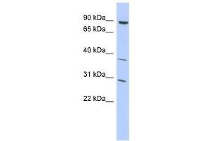 KLHL5 antibody used at 2. (KLHL5 Antikörper  (Middle Region))