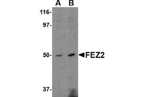 Western Blotting (WB) image for anti-Fasciculation and Elongation Protein zeta 2 (Zygin II) (FEZ2) (C-Term) antibody (ABIN1030393) (FEZ2 Antikörper  (C-Term))