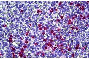 Anti-CAMP antibody IHC staining of human spleen, neutrophils. (Cathelicidin Antikörper)