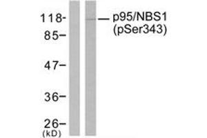 Western Blotting (WB) image for anti-Nibrin (NBN) (pSer343) antibody (ABIN2888479) (Nibrin Antikörper  (pSer343))