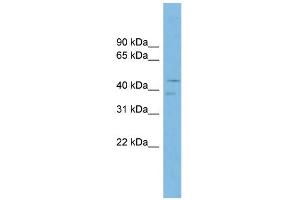 WB Suggested Anti-P2RXL1 Antibody Titration: 0. (P2RX6 Antikörper  (N-Term))