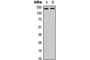 Western blot analysis of p65 expression in HEK293T (A), HeLa (B) whole cell lysates. (SYT1 Antikörper  (N-Term))