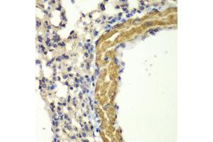 Immunohistochemistry of paraffin-embedded mouse lung using PRKG1 antibody (ABIN5971390) at dilution of 1/100 (40x lens). (PRKG1 Antikörper)