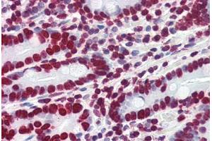 Human Small Intestine (formalin-fixed, paraffin-embedded) stained with HMGA1 antibody ABIN364402 at 4 ug/ml followed by biotinylated anti-goat IgG secondary antibody ABIN481715, alkaline phosphatase-streptavidin and chromogen. (HMGA1 Antikörper  (AA 12-23))