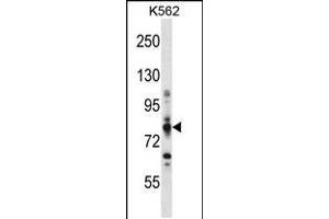 Western blot analysis in K562 cell line lysates (35ug/lane). (CPT1A Antikörper  (C-Term))