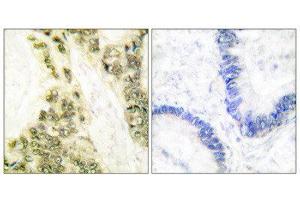 Immunohistochemistry (IHC) image for anti-Thyroid Hormone Receptor, alpha (THRA) (N-Term) antibody (ABIN1848805) (THRA Antikörper  (N-Term))