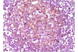 Immunohistochemistry (IHC) image for anti-CD14 (CD14) antibody (ABIN1105869) (CD14 Antikörper)