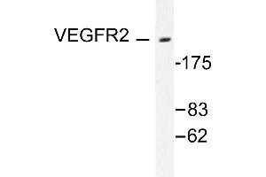 Image no. 1 for anti-VEGF Receptor 2 (VEGFR2) antibody (ABIN271861) (VEGFR2/CD309 Antikörper)