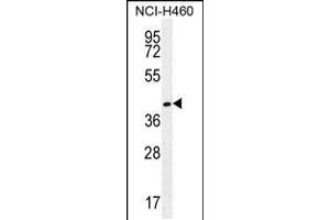 Western blot analysis in NCI-H460 cell line lysates (35ug/lane). (GGH Antikörper  (C-Term))
