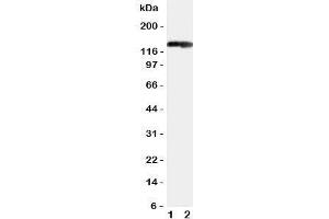 Western blot testing of COL2A1 antibody and Lane 1:  rat heart;  2: rat brain tissue lysate. (COL2A1 Antikörper  (C-Term))