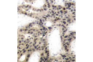 Immunohistochemistry (IHC) image for anti-Eukaryotic Translation Initiation Factor 4E Binding Protein 1 (EIF4EBP1) (pThr45) antibody (ABIN1870151) (eIF4EBP1 Antikörper  (pThr45))