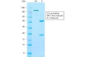 SDS-PAGE (SDS) image for anti-Calponin 1 (CNN1) antibody (ABIN6939165)