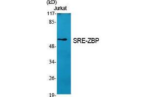 Western Blotting (WB) image for anti-Zinc Finger Protein 187 (ZNF187) (Internal Region) antibody (ABIN6283137) (ZNF187 Antikörper  (Internal Region))