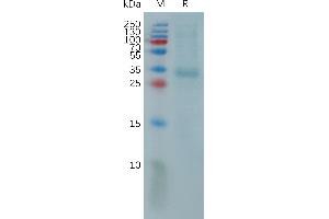 PRTN3 Protein (AA 26-256) (His tag)