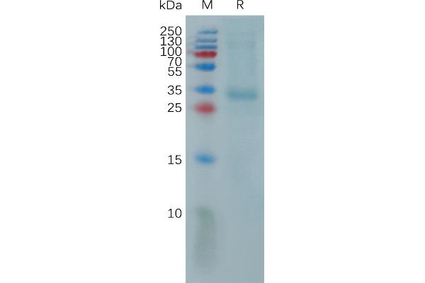 PRTN3 Protein (AA 26-256) (His tag)