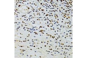 Immunohistochemistry of paraffin-embedded human vermiform appendix using ALYREF antibody (ABIN5973579) at dilution of 1/100 (40x lens). (THO Complex 4 Antikörper)