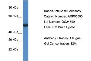 Western Blotting (WB) image for anti-Sestrin 1 (SESN1) (C-Term) antibody (ABIN2786033) (SESN1 Antikörper  (C-Term))