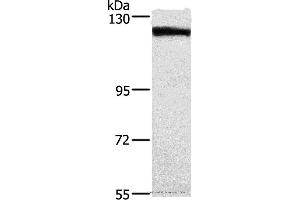 Western blot analysis of Human tongue cancer tissue, using DSG1 Polyclonal Antibody at dilution of 1:750 (Desmoglein 1 Antikörper)