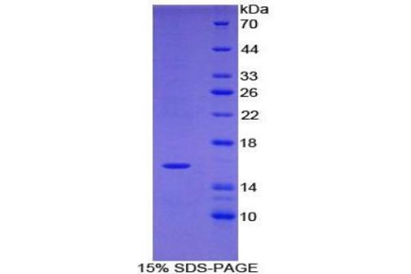 TPSD1 Protein