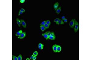 Immunofluorescent analysis of HepG2 cells using ABIN7146224 at dilution of 1:100 and Alexa Fluor 488-congugated AffiniPure Goat Anti-Rabbit IgG(H+L) (N-Cadherin Antikörper  (AA 746-906))