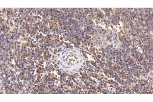 Detection of IL6 in Human Spleen Tissue using Monoclonal Antibody to Interleukin 6 (IL6) (IL-6 Antikörper  (AA 30-212))