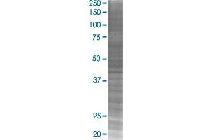 TFCP2 transfected lysate. (TFCP2 293T Cell Transient Overexpression Lysate(Denatured))