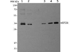 Image no. 1 for anti-Eukaryotic Translation Elongation Factor 1 beta 2 (EEF1B2) antibody (ABIN334557) (EEF1B2 Antikörper)