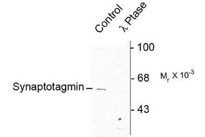 Image no. 1 for anti-Synaptotagmin I (SYT1) (pSer309) antibody (ABIN372725) (SYT1 Antikörper  (pSer309))