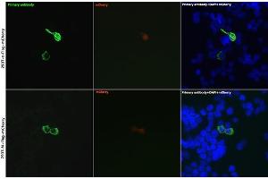 Immunofluorescence analysis of 293T cells transfected with Flag-c(mCherry) and 293T cells transfected with Flag-N(mCherry) use Rabbit anti DDDDK-Tag pAb (ABIN1512924 and ABIN5663537) at dilution of 1:50 (40x lens). (DYKDDDDK Tag Antikörper)