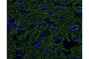 Indirect immunostaining of PFA fixed, paraffin embedded mouse brain (dilution 1 : 500; green). (Tubulin delta 2 (AA 443-449) Antikörper)