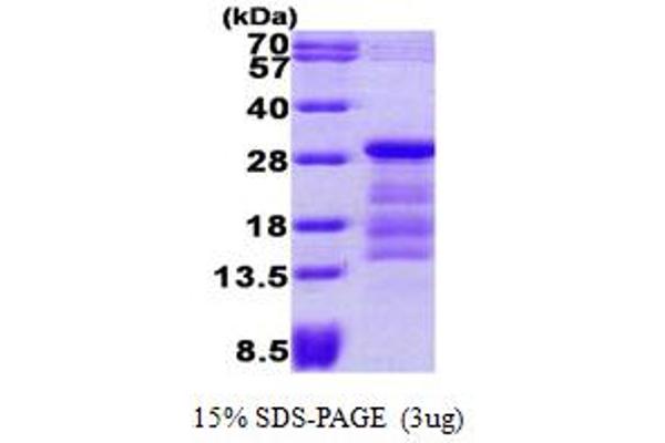 PTTG1 Protein (AA 1-202) (His tag)