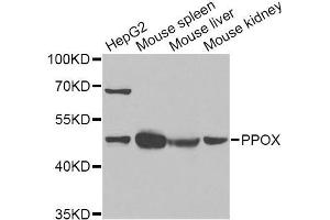 Western blot analysis of extracts of various cell lines, using PPOX Antibody (ABIN5973799) at 1/1000 dilution. (PPOX Antikörper)