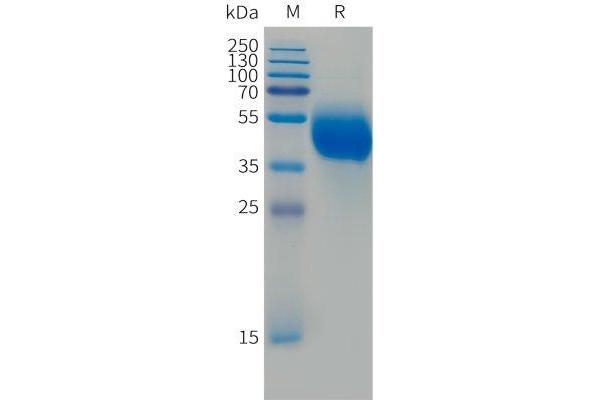 FCRL5 Protein (AA 745-847) (Fc Tag)