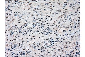 Immunohistochemical staining of paraffin-embedded Kidney tissue using anti-SSBmouse monoclonal antibody. (SSB Antikörper)