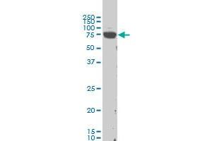 LIMK1 monoclonal antibody (M02), clone 1B2 Western Blot analysis of LIMK1 expression in Hela S3 NE . (LIM Domain Kinase 1 Antikörper  (AA 548-647))