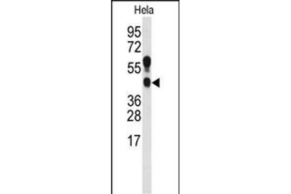 PRMT1 Antikörper  (C-Term)