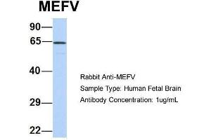 Host:  Rabbit  Target Name:  MEFV  Sample Type:  Human Fetal Brain  Antibody Dilution:  1. (MEFV Antikörper  (N-Term))